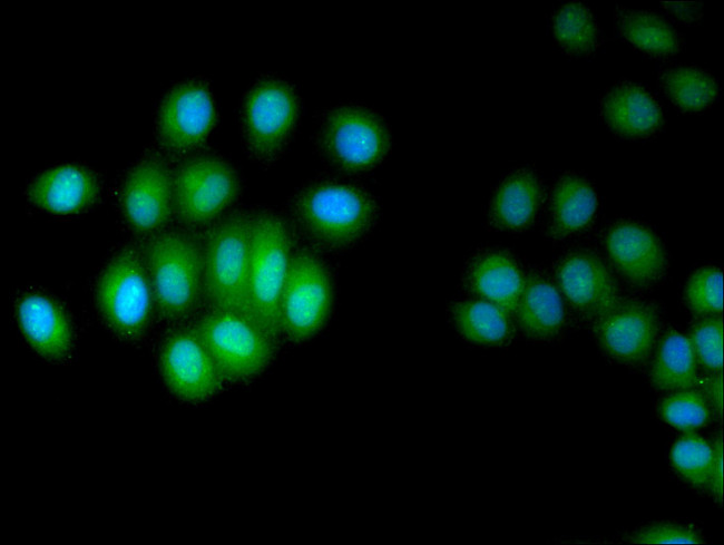 HUS1 Antibody in Immunocytochemistry (ICC/IF)