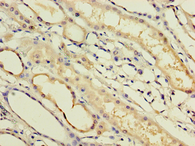 IFNA14 Antibody in Immunohistochemistry (Paraffin) (IHC (P))