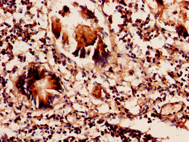SRM Antibody in Immunohistochemistry (Paraffin) (IHC (P))