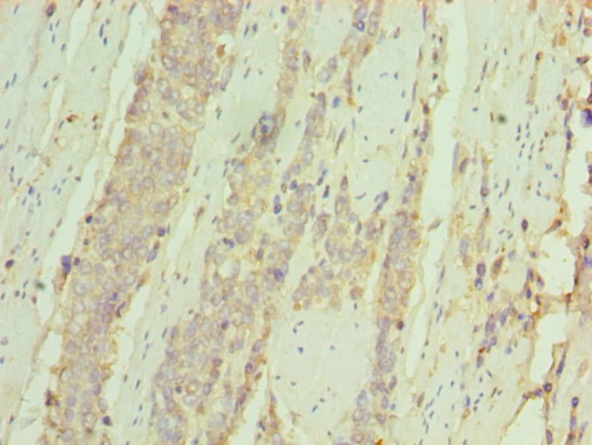 CD127 Antibody in Immunohistochemistry (Paraffin) (IHC (P))