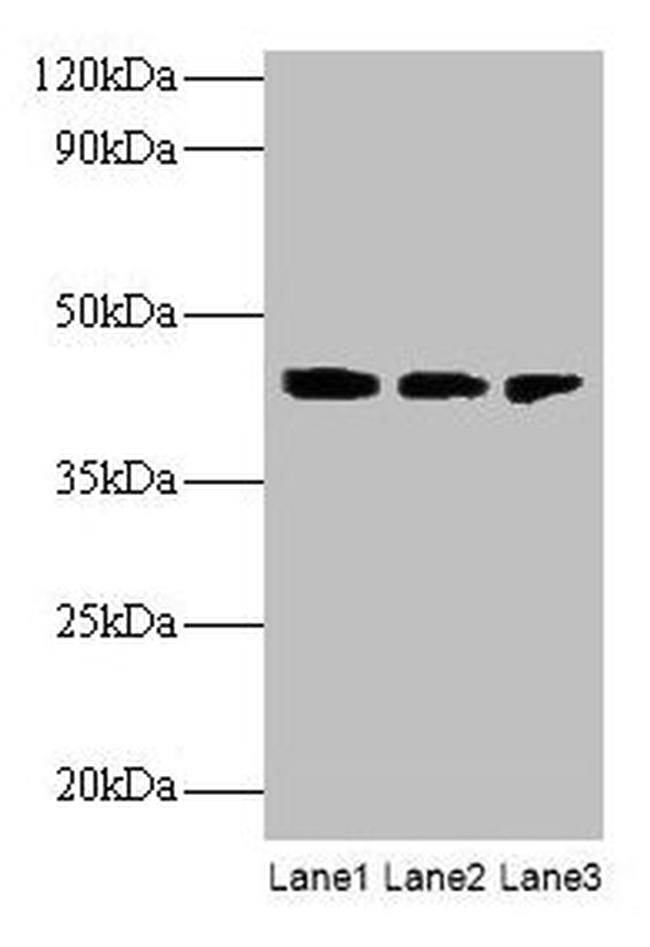 ILKAP Antibody in Western Blot (WB)
