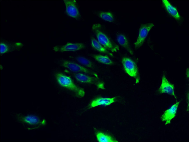 ILVBL Antibody in Immunocytochemistry (ICC/IF)