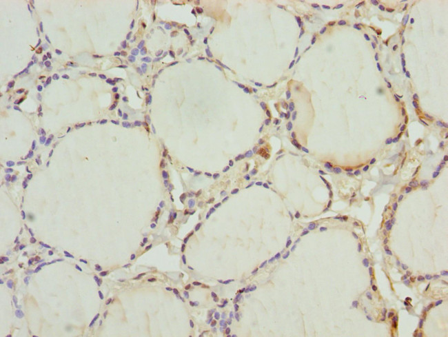 INHBC Antibody in Immunohistochemistry (Paraffin) (IHC (P))