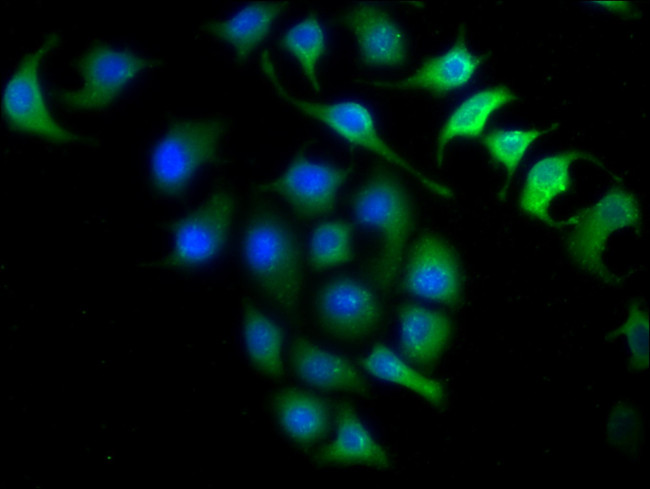 INMT Antibody in Immunocytochemistry (ICC/IF)