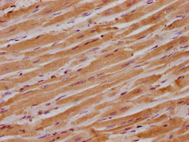 ITGB1BP1 Antibody in Immunohistochemistry (Paraffin) (IHC (P))