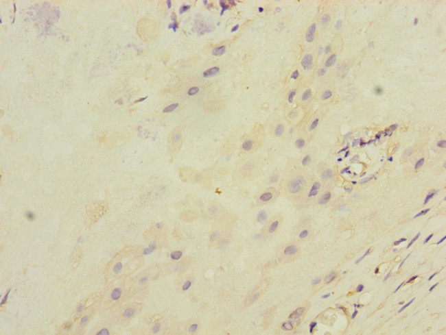 ITGB8 Antibody in Immunohistochemistry (Paraffin) (IHC (P))