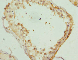 KIF3A Antibody in Immunohistochemistry (Paraffin) (IHC (P))