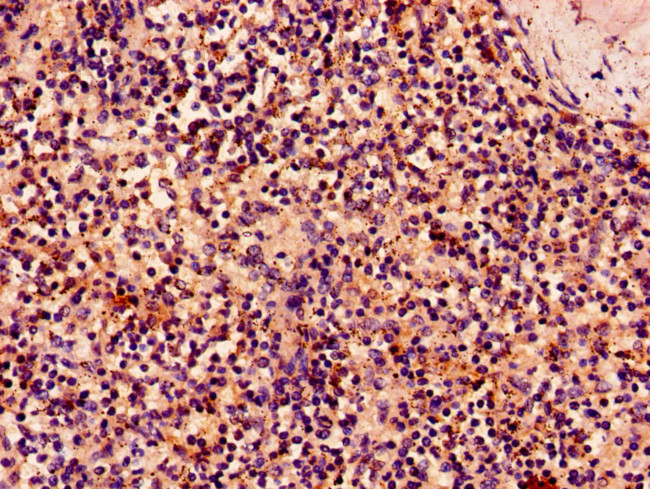 NKG2D Antibody in Immunohistochemistry (Paraffin) (IHC (P))