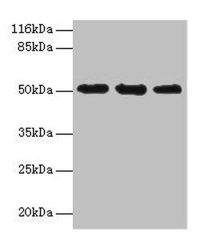KRT38 Antibody in Western Blot (WB)