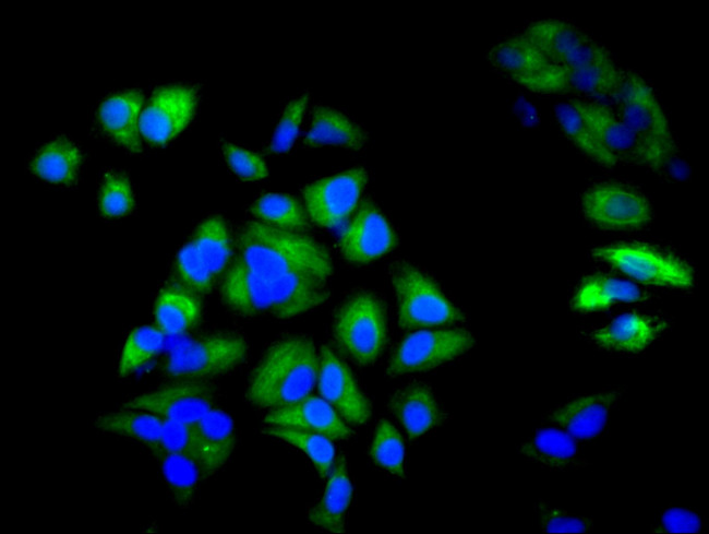 Cytokeratin 6A Antibody in Immunocytochemistry (ICC/IF)
