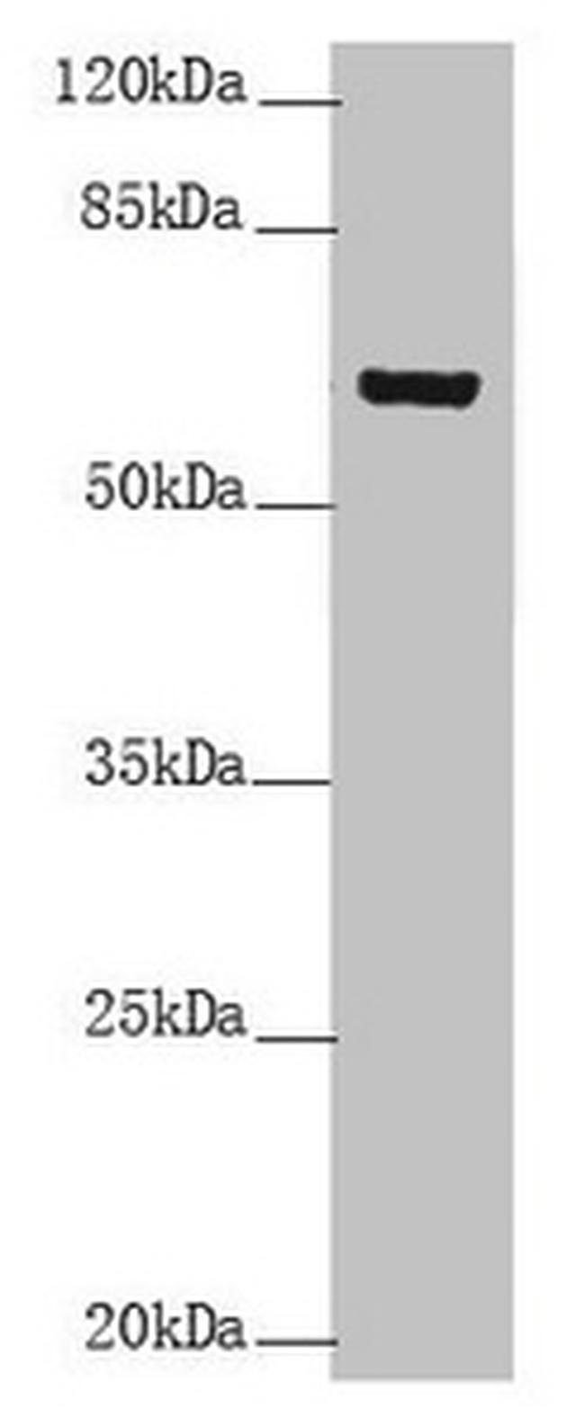 Cytokeratin 6B Antibody in Western Blot (WB)