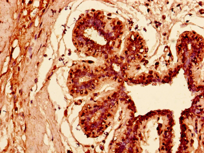 KRT81 Antibody in Immunohistochemistry (Paraffin) (IHC (P))