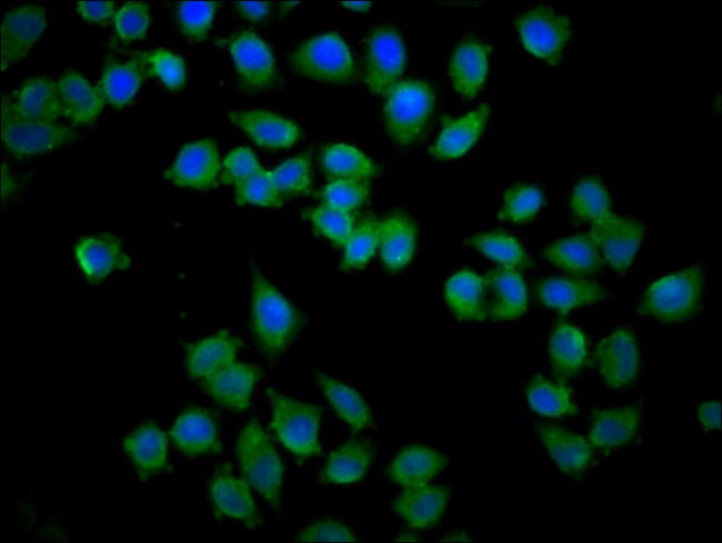 KY Antibody in Immunocytochemistry (ICC/IF)