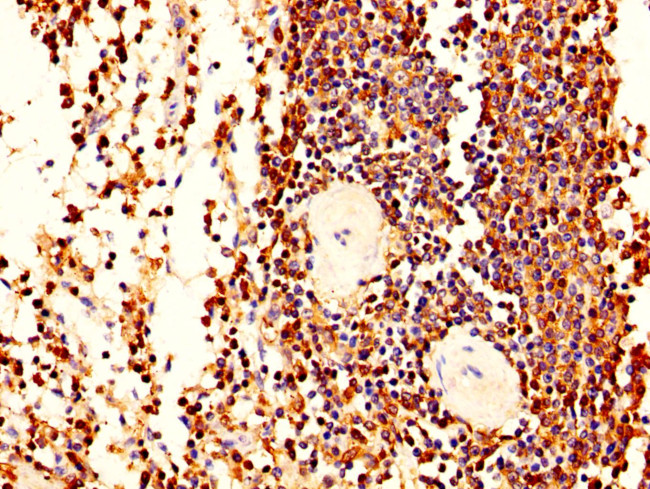 L-Plastin Antibody in Immunohistochemistry (Paraffin) (IHC (P))