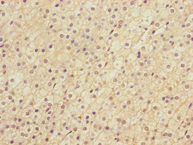 LRP4 Antibody in Immunohistochemistry (Paraffin) (IHC (P))