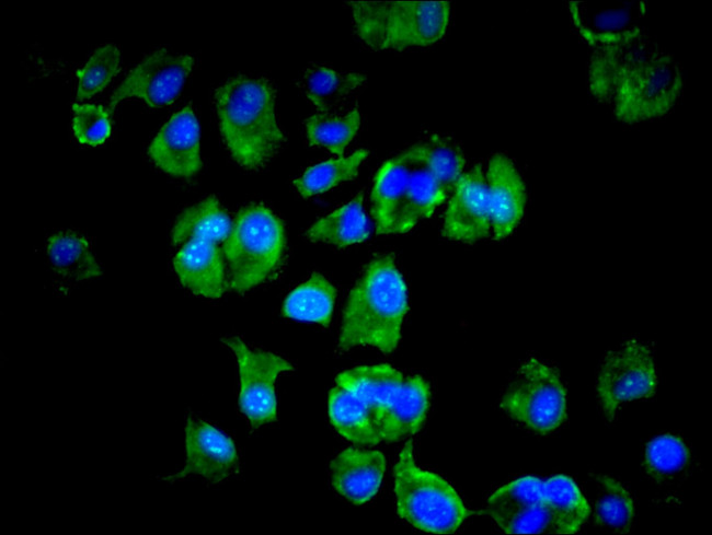 LSM4 Antibody in Immunocytochemistry (ICC/IF)