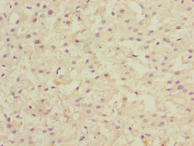 LSS Antibody in Immunohistochemistry (Paraffin) (IHC (P))