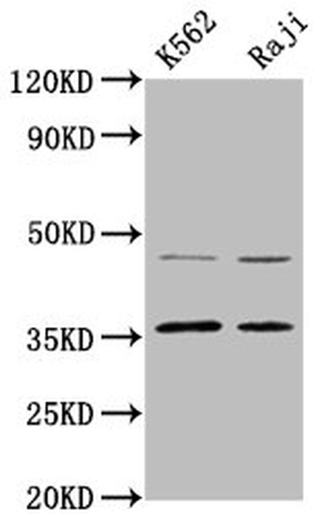MAGEA2 Antibody in Western Blot (WB)