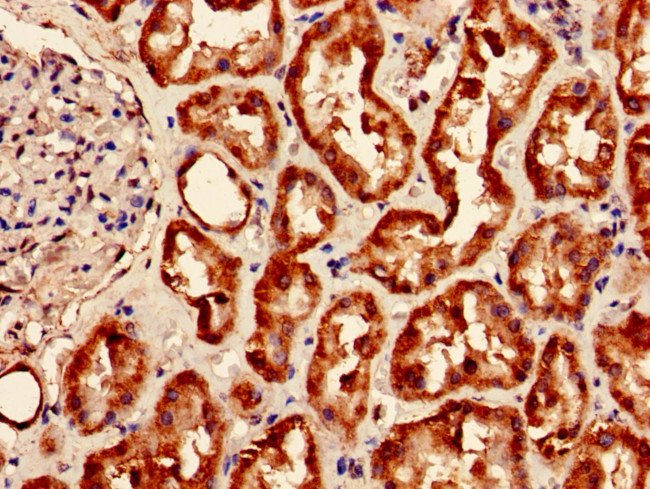 MAOA Antibody in Immunohistochemistry (Paraffin) (IHC (P))