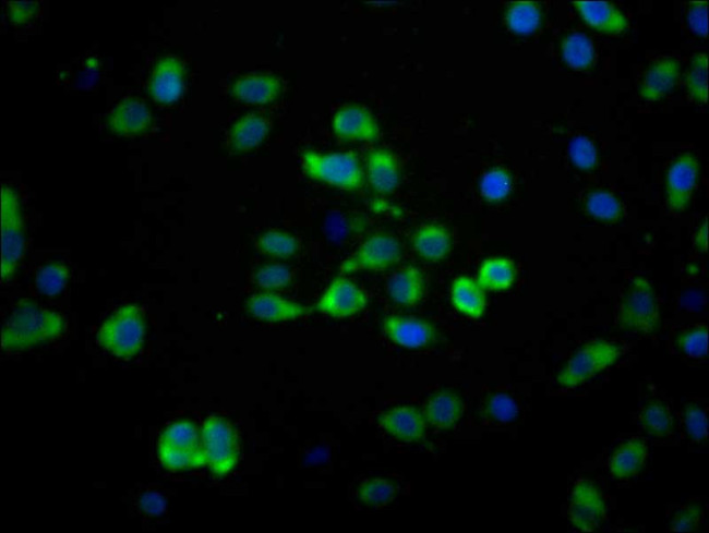 MAS1 Antibody in Immunocytochemistry (ICC/IF)