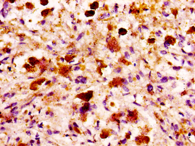 MASP2 Antibody in Immunohistochemistry (Paraffin) (IHC (P))