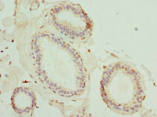 MATK Antibody in Immunohistochemistry (Paraffin) (IHC (P))