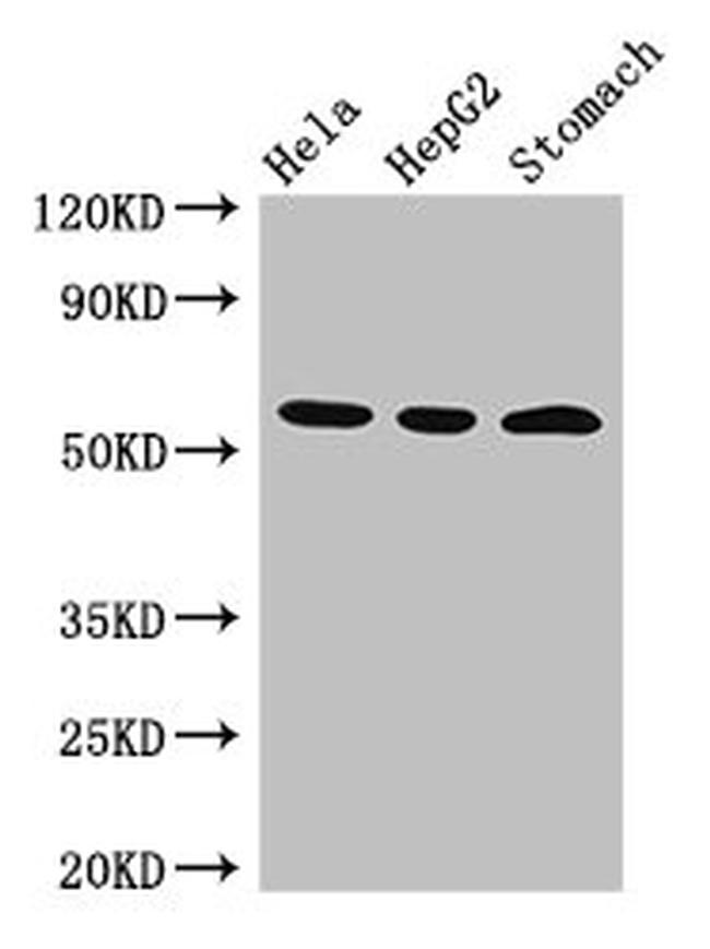 MDMX Antibody in Western Blot (WB)