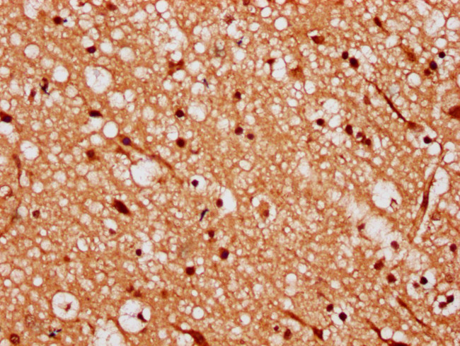 RKHD4 Antibody in Immunohistochemistry (Paraffin) (IHC (P))