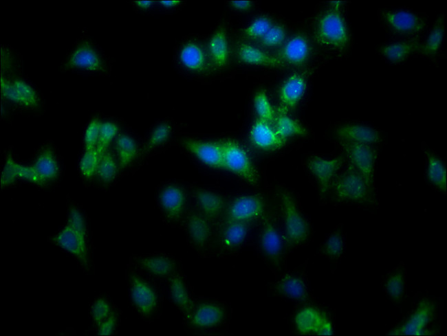 MMGT1 Antibody in Immunocytochemistry (ICC/IF)
