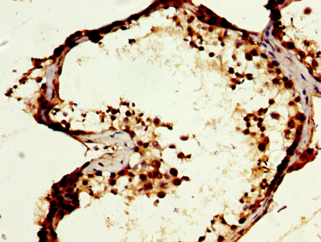 MOS Antibody in Immunohistochemistry (Paraffin) (IHC (P))