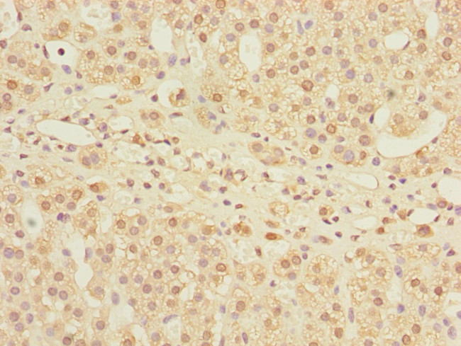 MPI Antibody in Immunohistochemistry (Paraffin) (IHC (P))