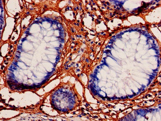 MRPL3 Antibody in Immunohistochemistry (Paraffin) (IHC (P))