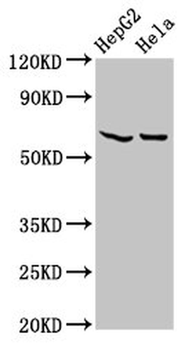 MT-ND5 Antibody in Western Blot (WB)