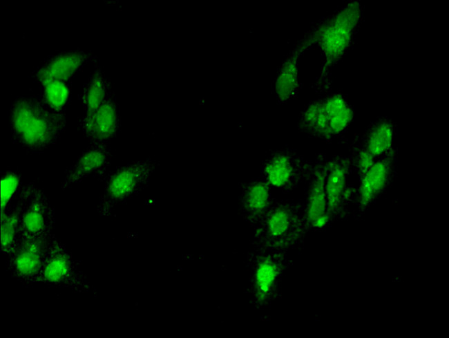 MYF6 Antibody in Immunocytochemistry (ICC/IF)