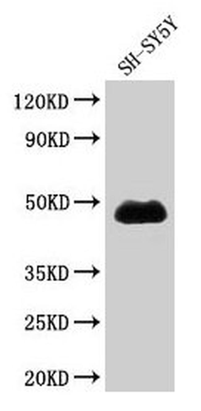 NADK Antibody in Western Blot (WB)