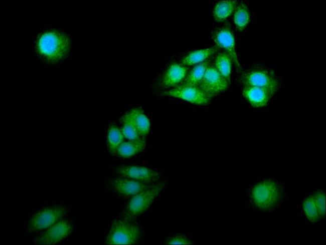 NCDN Antibody in Immunocytochemistry (ICC/IF)