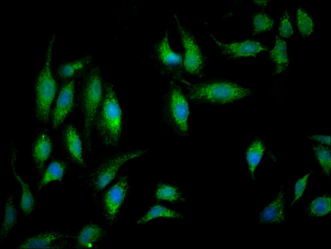 NDUFB5 Antibody in Immunocytochemistry (ICC/IF)