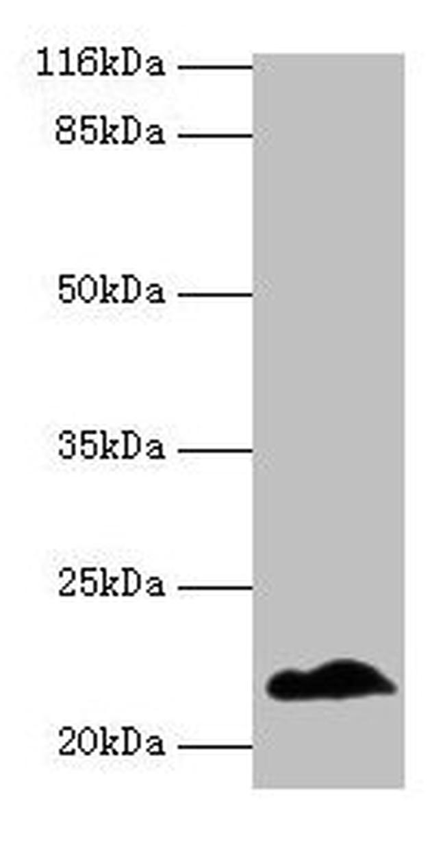 NDUFB5 Antibody in Western Blot (WB)