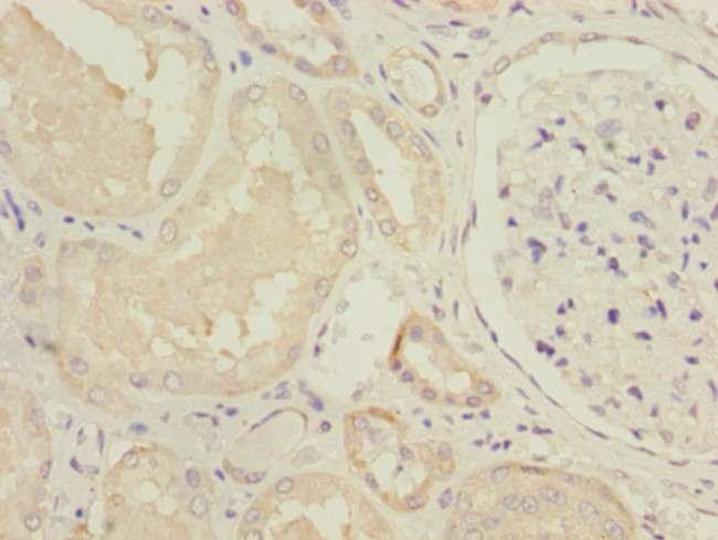 NDUFV1 Antibody in Immunohistochemistry (Paraffin) (IHC (P))
