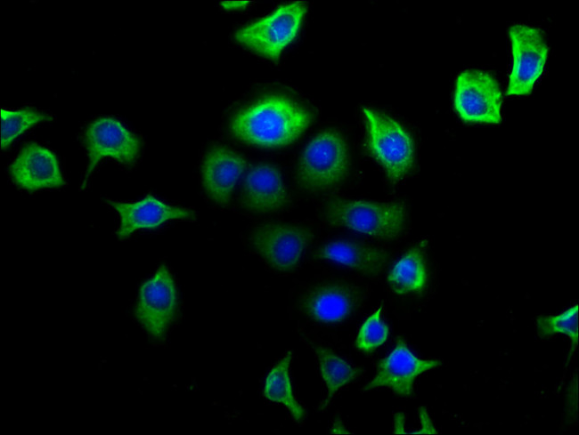 NPY2R Antibody in Immunocytochemistry (ICC/IF)