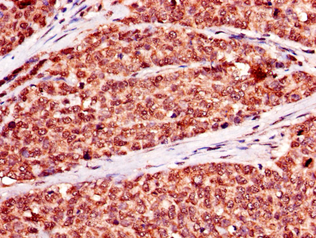 NR2C2AP Antibody in Immunohistochemistry (Paraffin) (IHC (P))