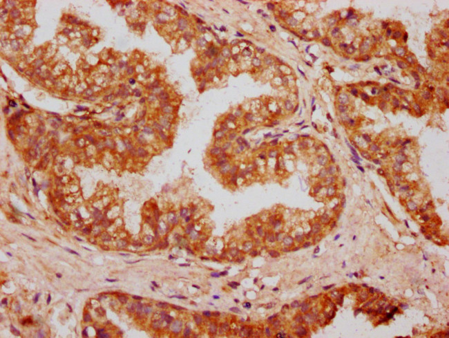 OMD Antibody in Immunohistochemistry (Paraffin) (IHC (P))