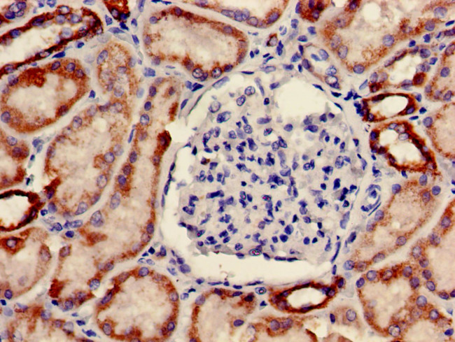ONECUT2 Antibody in Immunohistochemistry (Paraffin) (IHC (P))