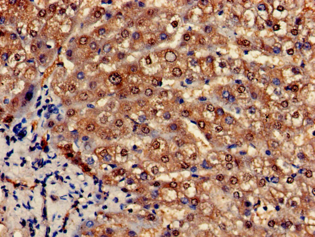 PCCA Antibody in Immunohistochemistry (Paraffin) (IHC (P))