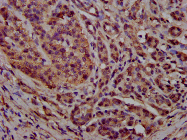 PCCB Antibody in Immunohistochemistry (Paraffin) (IHC (P))