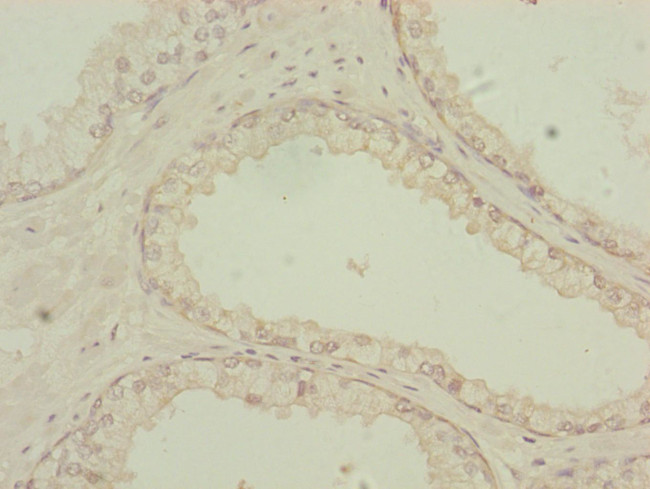 PDHA2 Antibody in Immunohistochemistry (Paraffin) (IHC (P))
