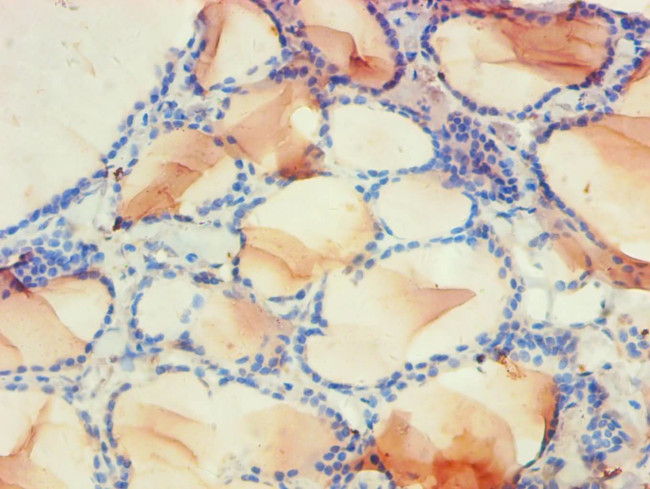 PDPK1 Antibody in Immunohistochemistry (Paraffin) (IHC (P))