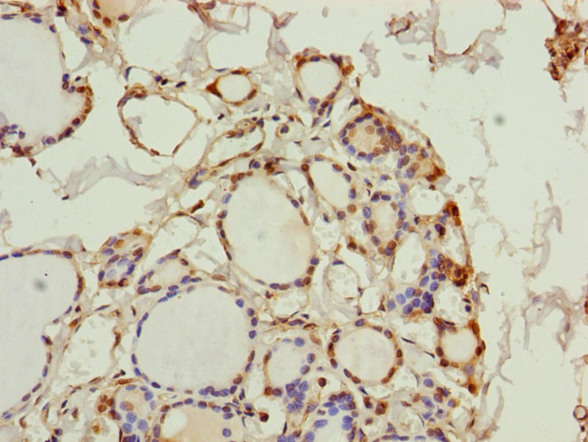 PGLS Antibody in Immunohistochemistry (Paraffin) (IHC (P))