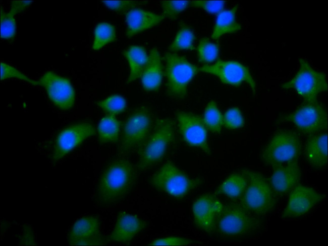 PHACTR1 Antibody in Immunocytochemistry (ICC/IF)