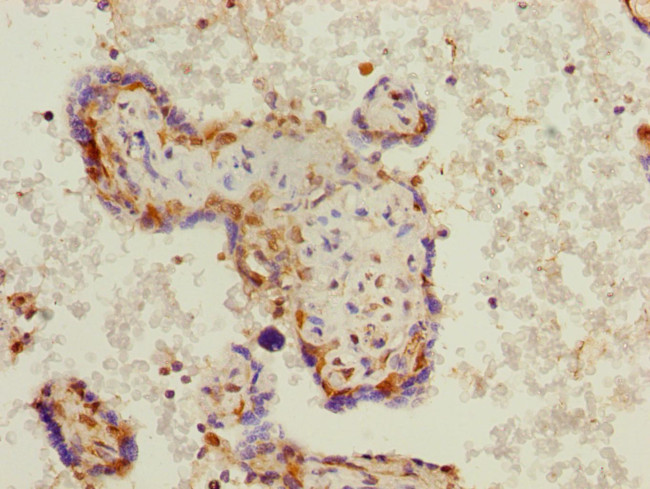 PHF11 Antibody in Immunohistochemistry (Paraffin) (IHC (P))